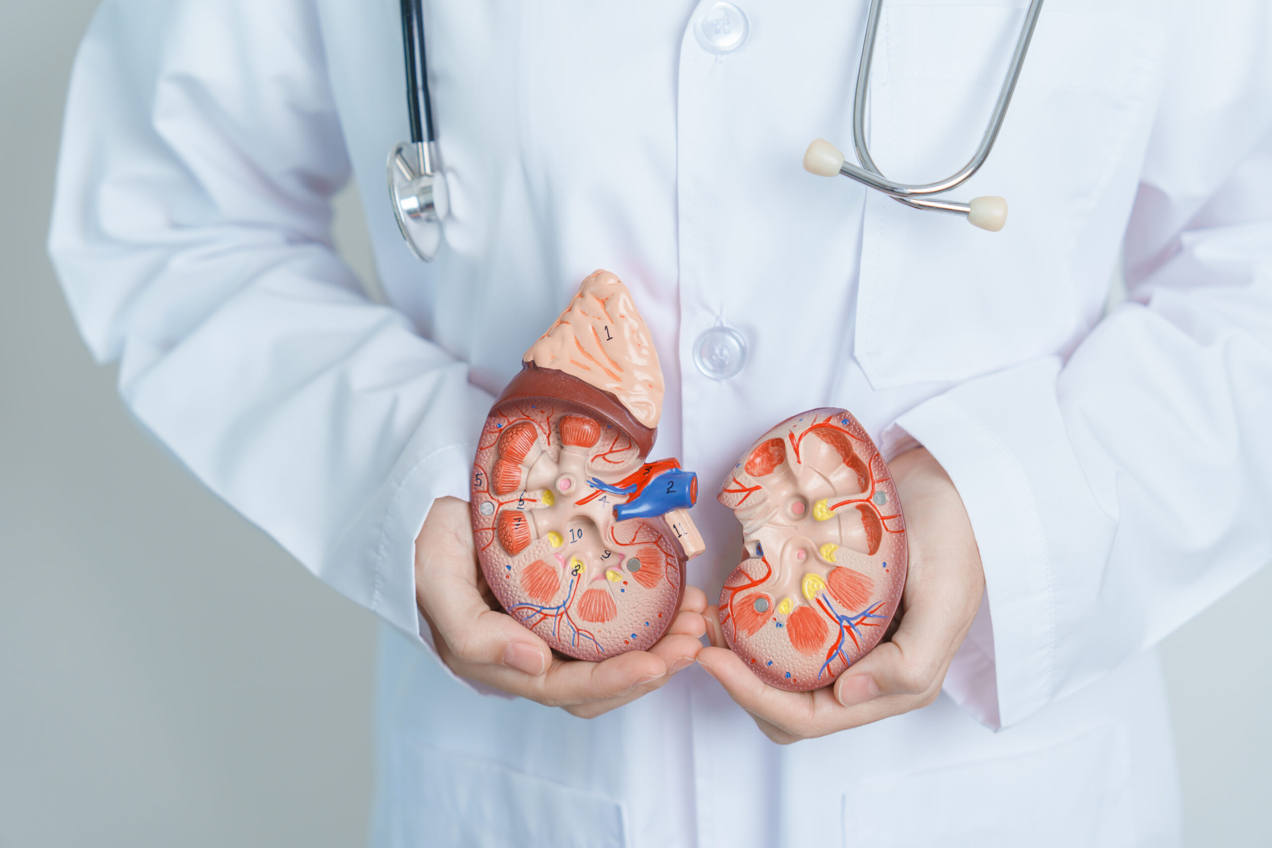 Doctor holding Anatomical kidney Adrenal gland model. disease of Urinary system and Stones, Cancer, world kidney day, Chronic kidney, Urology, Nephritis, Renal and Transplant concept
